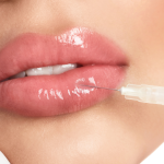 The Dangerous Truth About Lip Fillers